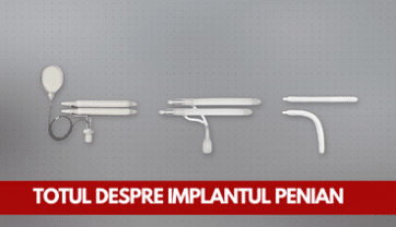 Totul despre implantul penian: Cum funcționează si căt de sigur este ?